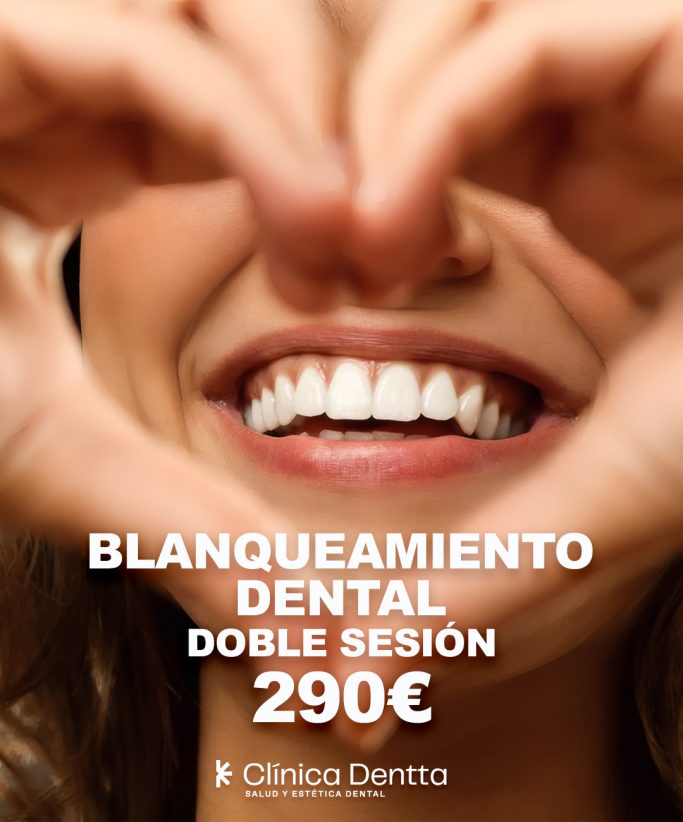 Blanqueamiento dental 290€
