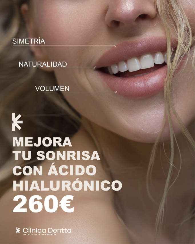 Acido hialurónico 260€