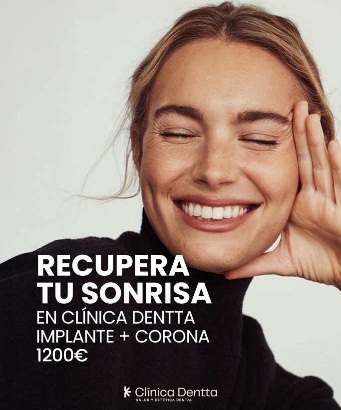 Implante + Corona 1200€